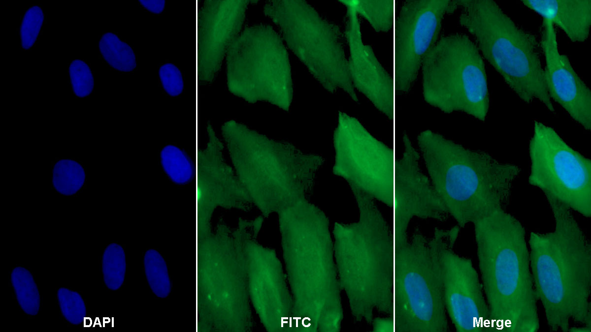 Monoclonal Antibody to Actin Alpha 1, Cardiac Muscle (ACTC1)