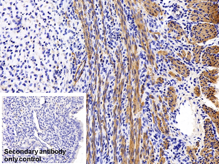 Monoclonal Antibody to Actin Alpha 1, Cardiac Muscle (ACTC1)