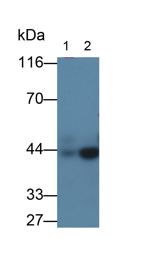 Monoclonal Antibody to Actin Alpha 2, Smooth Muscle (ACTa2)