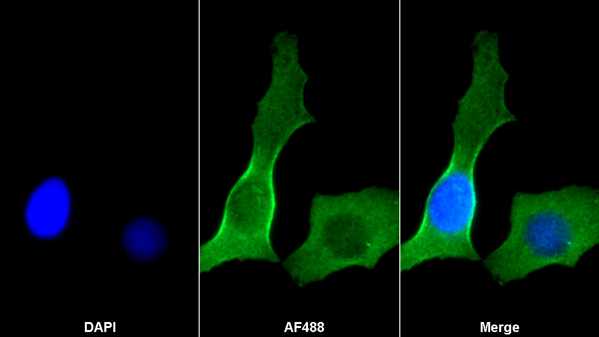 Monoclonal Antibody to Actin Alpha 2, Smooth Muscle (ACTa2)