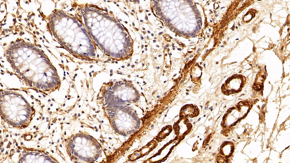 Monoclonal Antibody to Actin Alpha 2, Smooth Muscle (ACTa2)