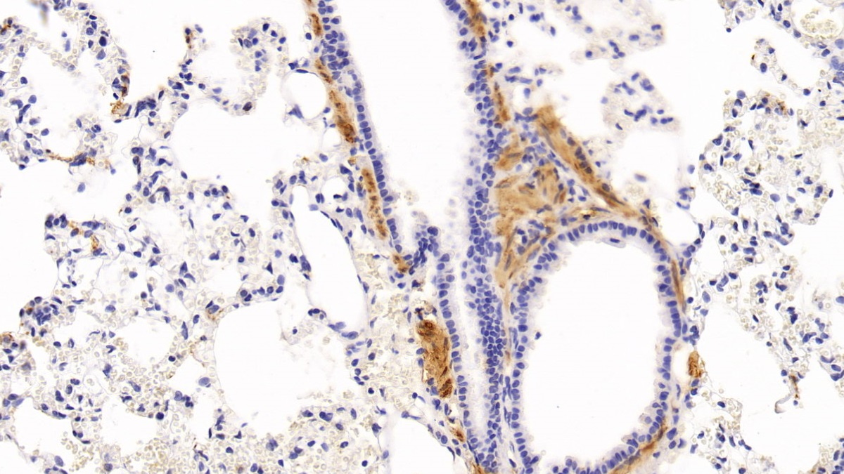 Monoclonal Antibody to Actin Alpha 2, Smooth Muscle (ACTa2)