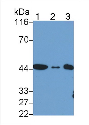 Monoclonal Antibody to Actin Alpha 2, Smooth Muscle (ACTa2)