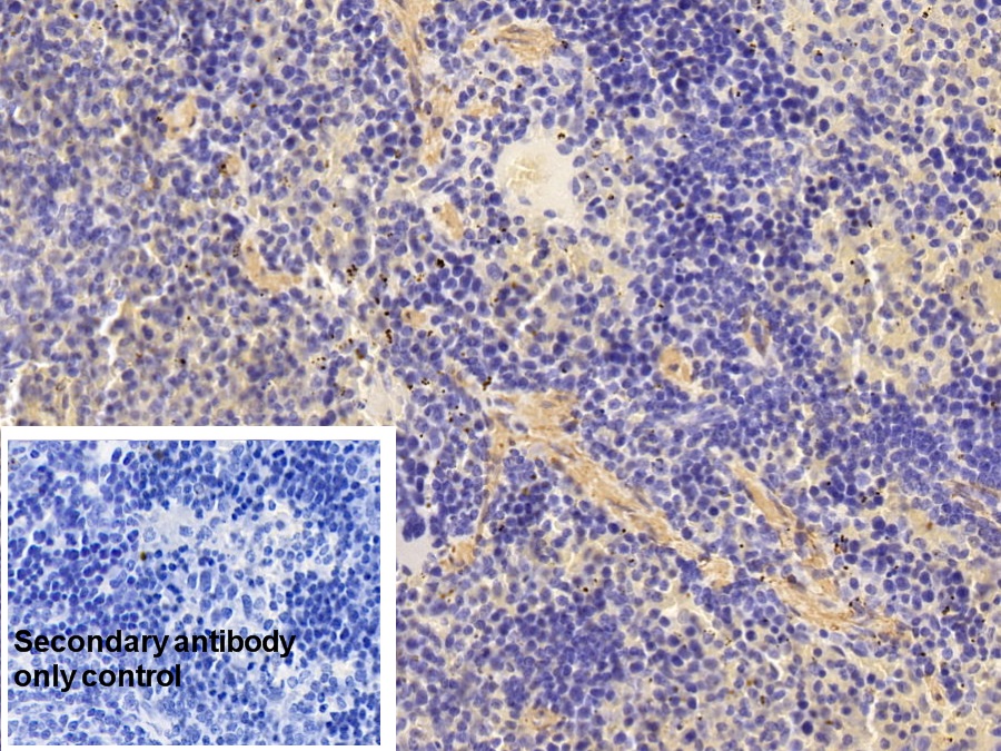 Monoclonal Antibody to Actin Alpha 2, Smooth Muscle (ACTa2)