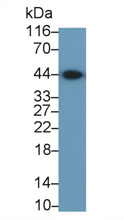 Monoclonal Antibody to Actin Alpha 2, Smooth Muscle (ACTa2)