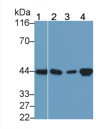 Monoclonal Antibody to Actin Alpha 2, Smooth Muscle (ACTa2)