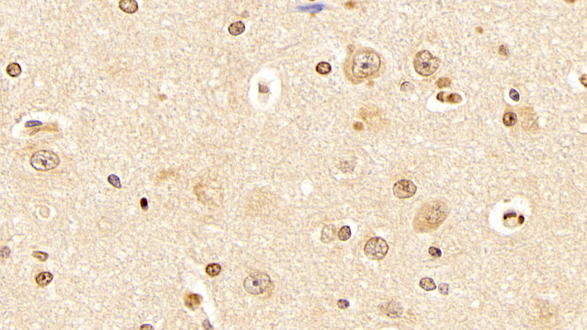 Monoclonal Antibody to Aryl Hydrocarbon Receptor (AhR)