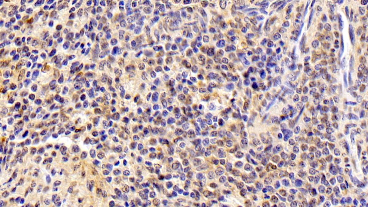 Monoclonal Antibody to Aryl Hydrocarbon Receptor (AhR)