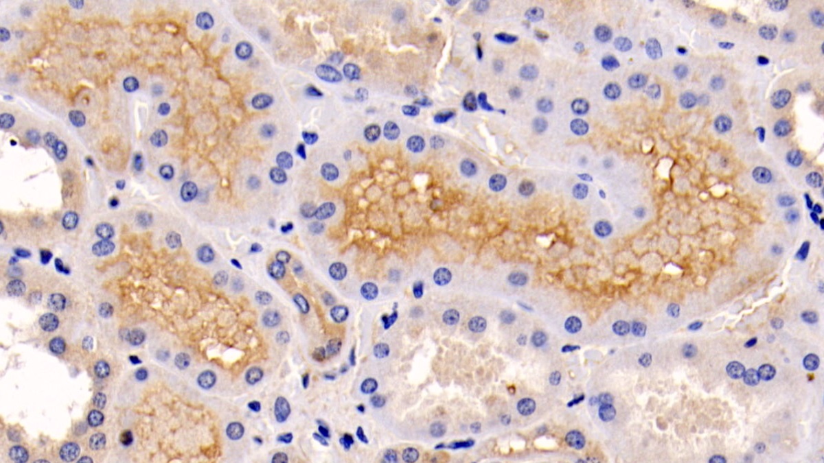 Monoclonal Antibody to Extracellular Signal Regulated Kinase 1 (ERK1)