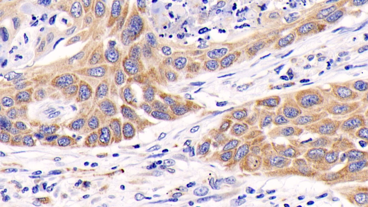 Monoclonal Antibody to Extracellular Signal Regulated Kinase 1 (ERK1)