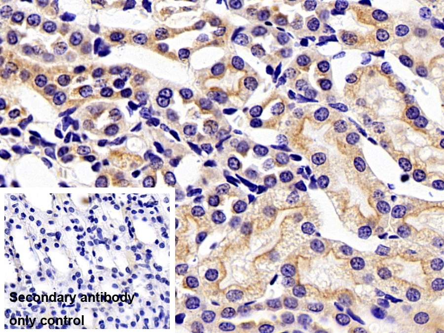 Monoclonal Antibody to Glucokinase Regulatory Protein (GKRP)