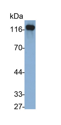 Monoclonal Antibody to Cadherin 5 (CDH5)