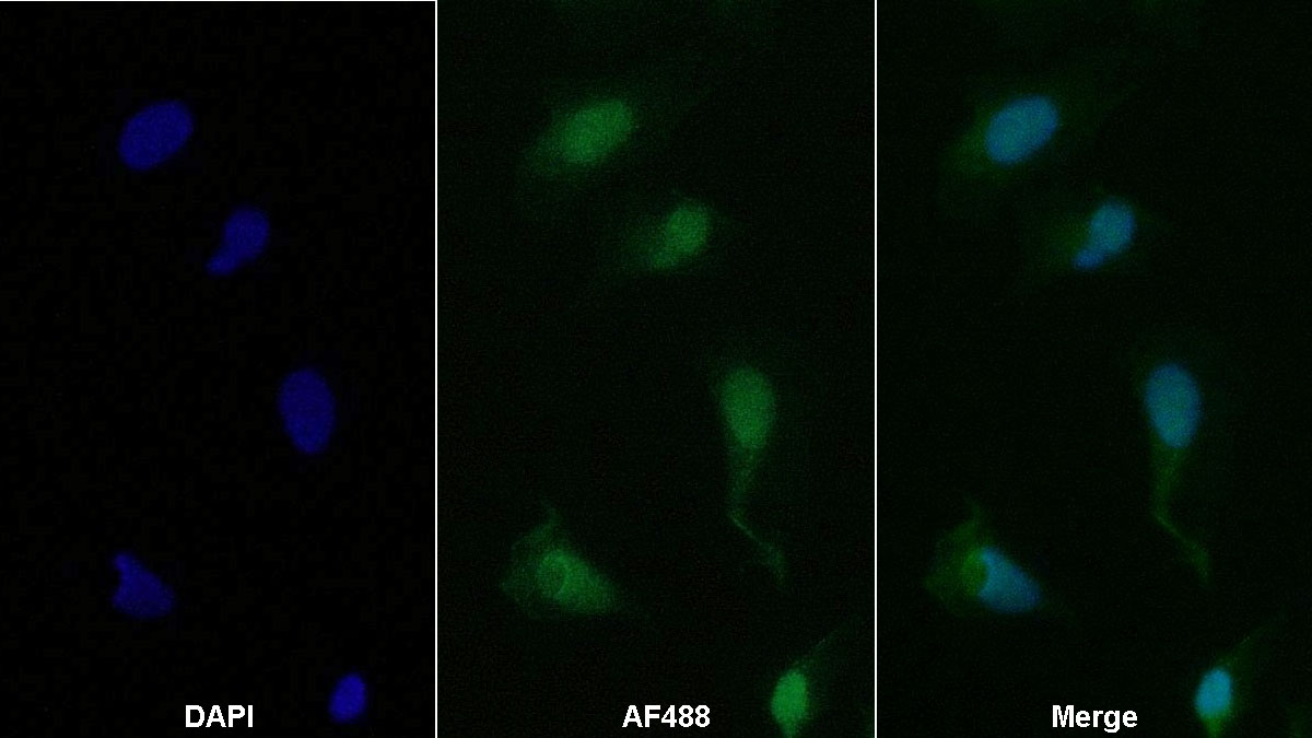 Monoclonal Antibody to Cadherin 5 (CDH5)