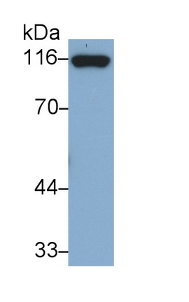 Monoclonal Antibody to Cadherin 5 (CDH5)