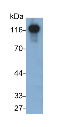 Monoclonal Antibody to Cadherin 5 (CDH5)