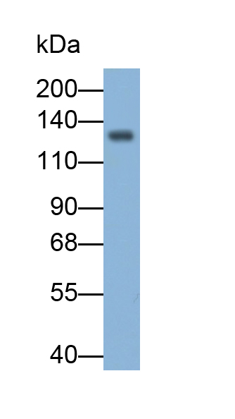 Monoclonal Antibody to Cadherin 5 (CDH5)