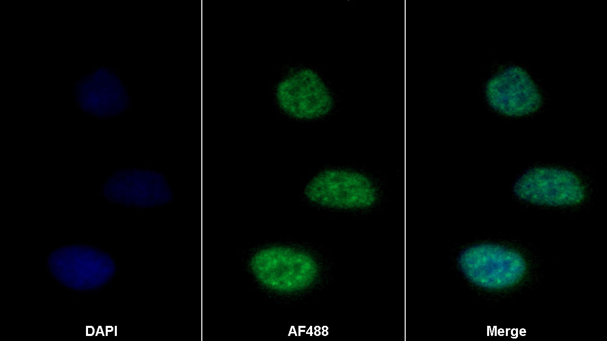 Monoclonal Antibody to Cadherin 5 (CDH5)