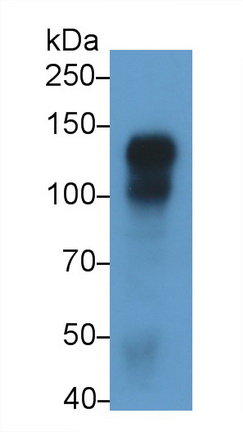 Monoclonal Antibody to Cadherin 5 (CDH5)