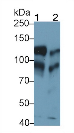 Monoclonal Antibody to Cadherin 5 (CDH5)