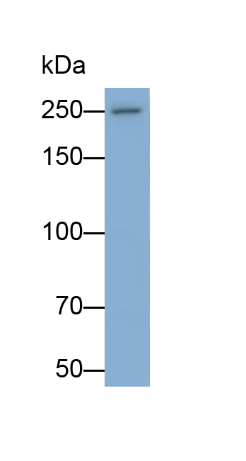 Monoclonal Antibody to Vascular Endothelial Growth Factor Receptor 2 (VEGFR2)