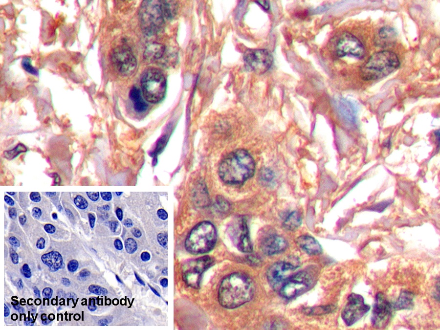 Monoclonal Antibody to Serpin B3 (SERPINB3)