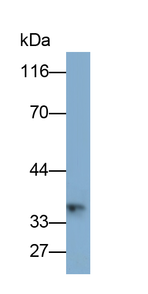 Monoclonal Antibody to Cluster of Differentiation 79B (CD79B)