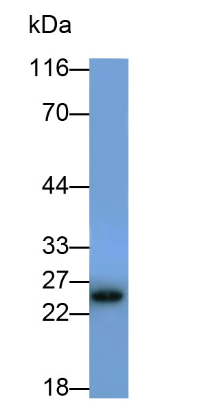 Monoclonal Antibody to Cluster of Differentiation 79B (CD79B)