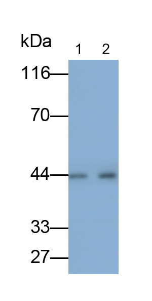 Monoclonal Antibody to Cluster of Differentiation 79B (CD79B)