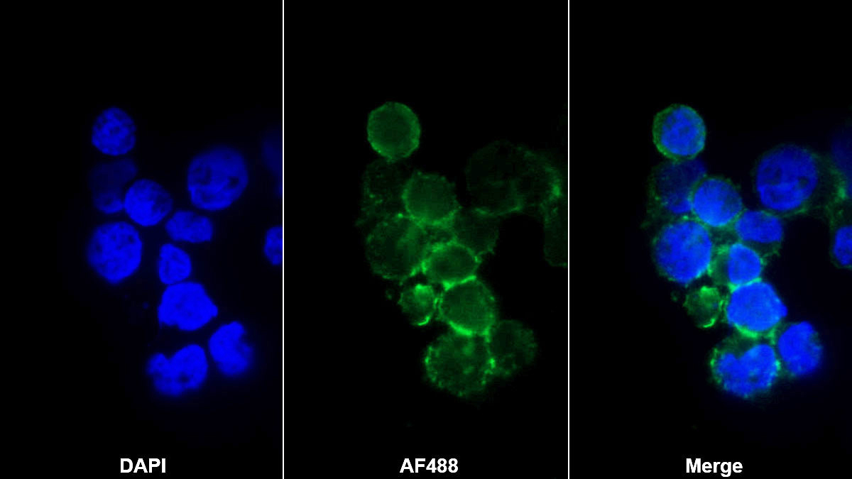 Monoclonal Antibody to Cluster of Differentiation 79B (CD79B)