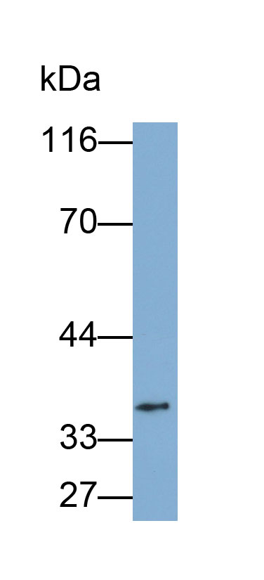 Monoclonal Antibody to Cluster of Differentiation 79B (CD79B)