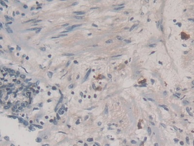 Monoclonal Antibody to Neutrophil gelatinase-associated lipocalin (NGAL)