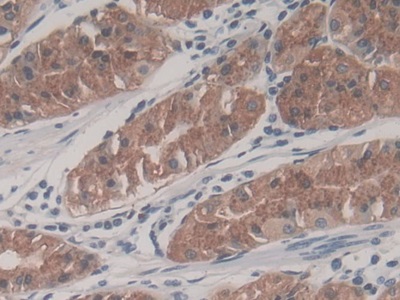 Monoclonal Antibody to Neutrophil gelatinase-associated lipocalin (NGAL)