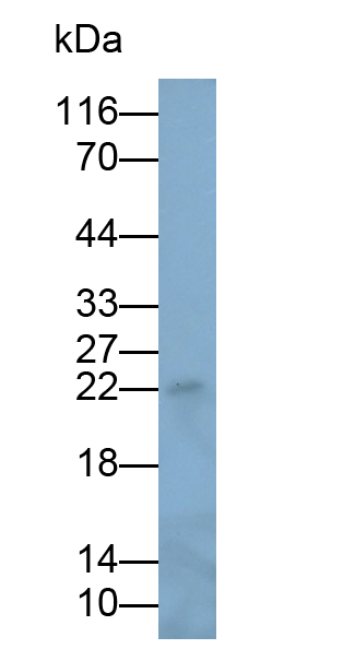 Monoclonal Antibody to Neutrophil gelatinase-associated lipocalin (NGAL)