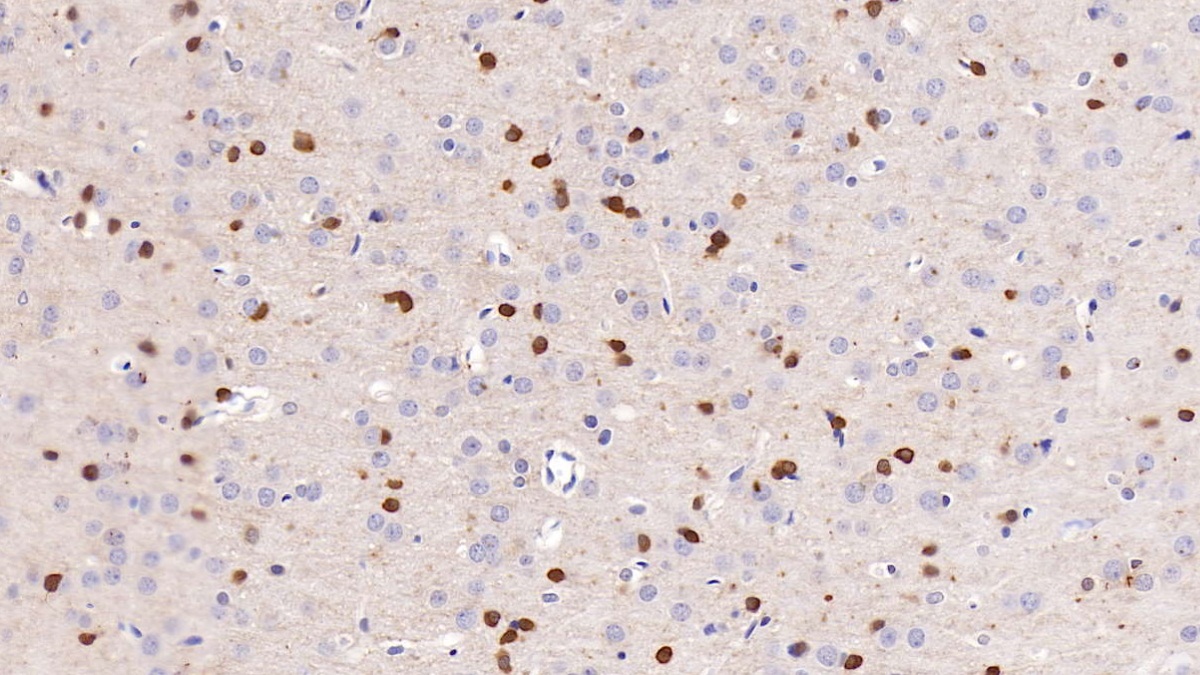 Monoclonal Antibody to Neutrophil gelatinase-associated lipocalin (NGAL)