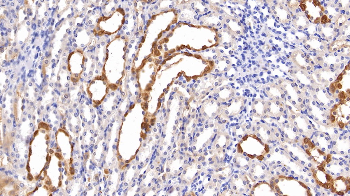 Monoclonal Antibody to Neutrophil gelatinase-associated lipocalin (NGAL)