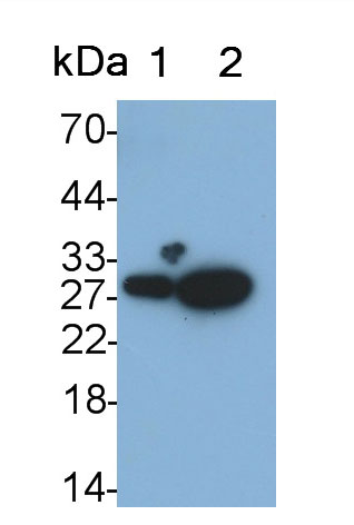 Monoclonal Antibody to Neutrophil gelatinase-associated lipocalin (NGAL)