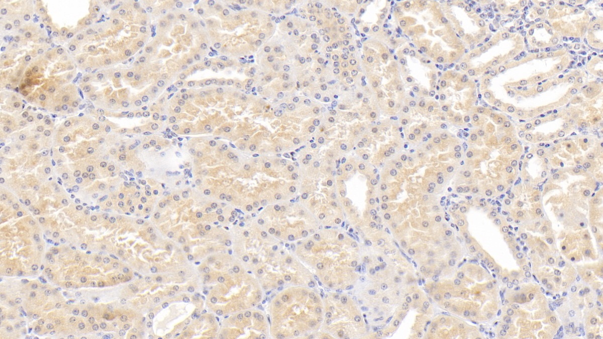 Monoclonal Antibody to Lipopolysaccharide Binding Protein (LBP)