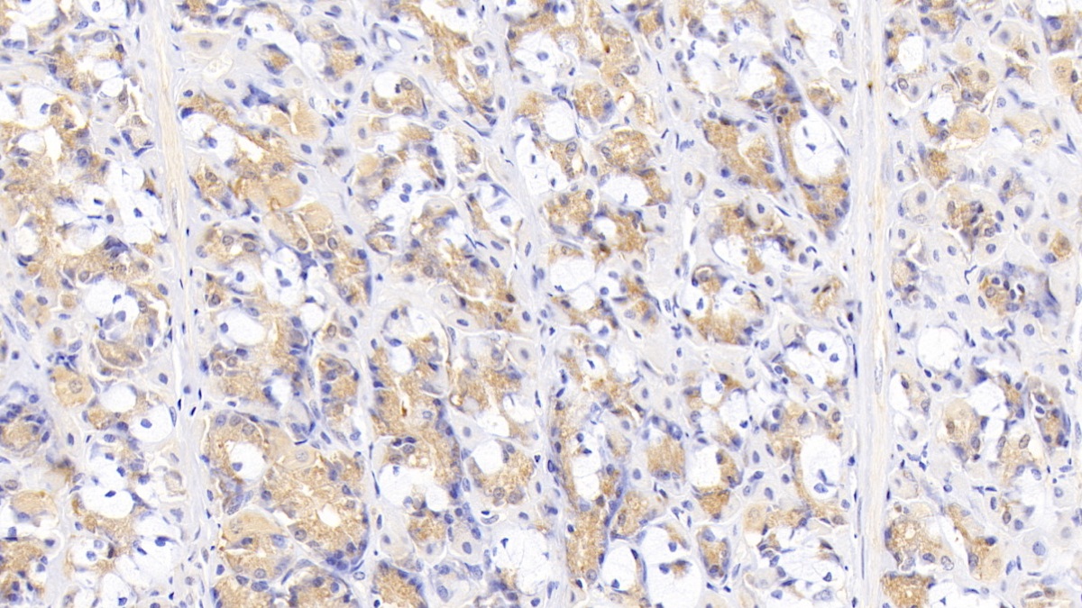 Monoclonal Antibody to Lipopolysaccharide Binding Protein (LBP)