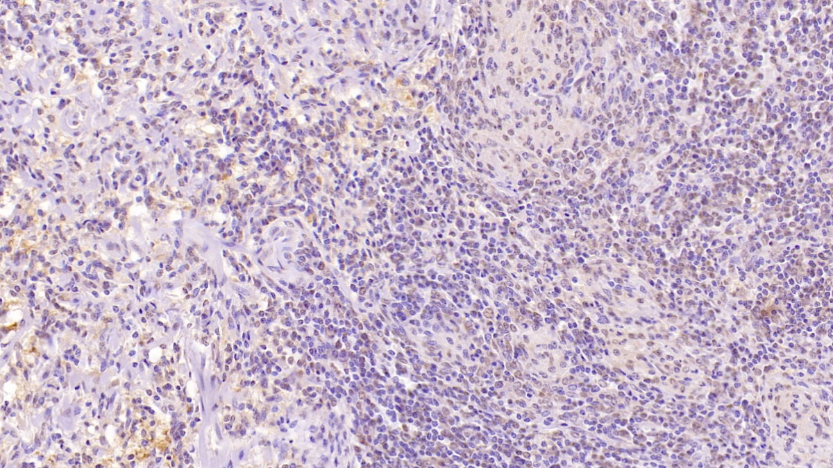 Monoclonal Antibody to Cluster Of Differentiation 97 (CD97)