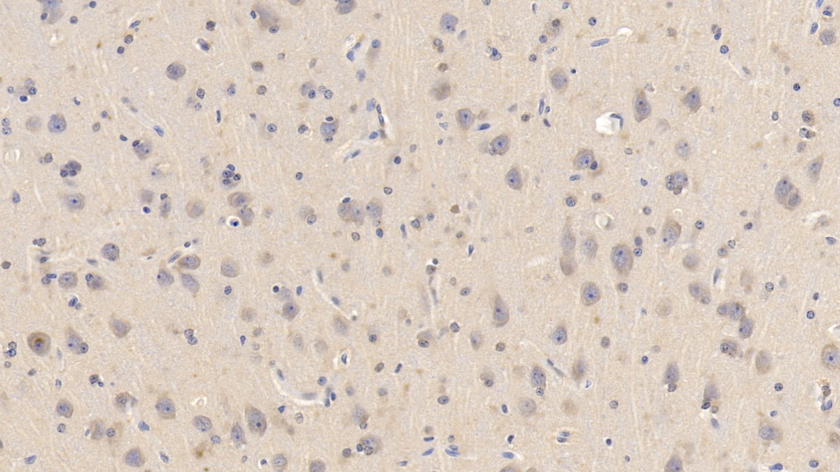 Monoclonal Antibody to Interferon Alpha/Beta Receptor 1 (IFNa/bR1)