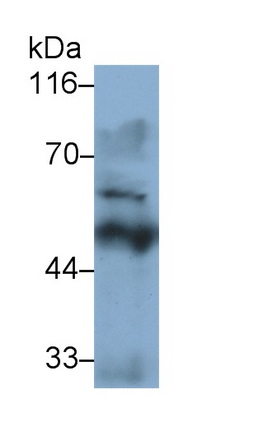 Monoclonal Antibody to Tyrosine Hydroxylase (TH)