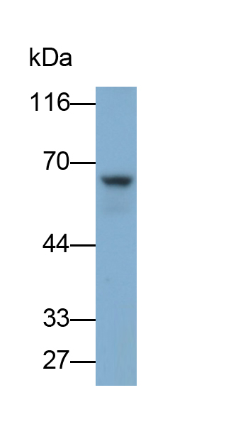 Monoclonal Antibody to Tyrosine Hydroxylase (TH)