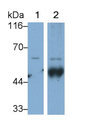 Monoclonal Antibody to Tyrosine Hydroxylase (TH)