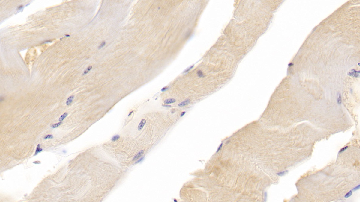 Monoclonal Antibody to Acetylcholinesterase (ACHE)