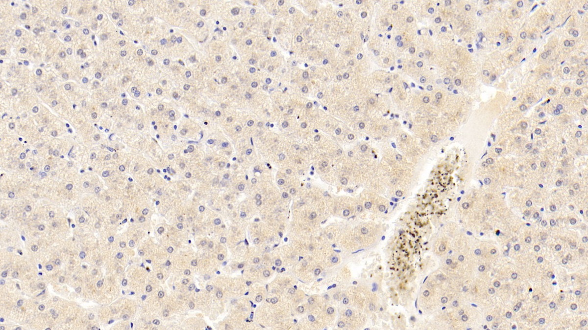 Monoclonal Antibody to Acetylcholinesterase (ACHE)