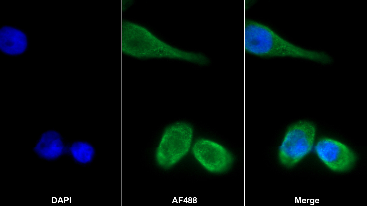 Monoclonal Antibody to Acetylcholinesterase (ACHE)