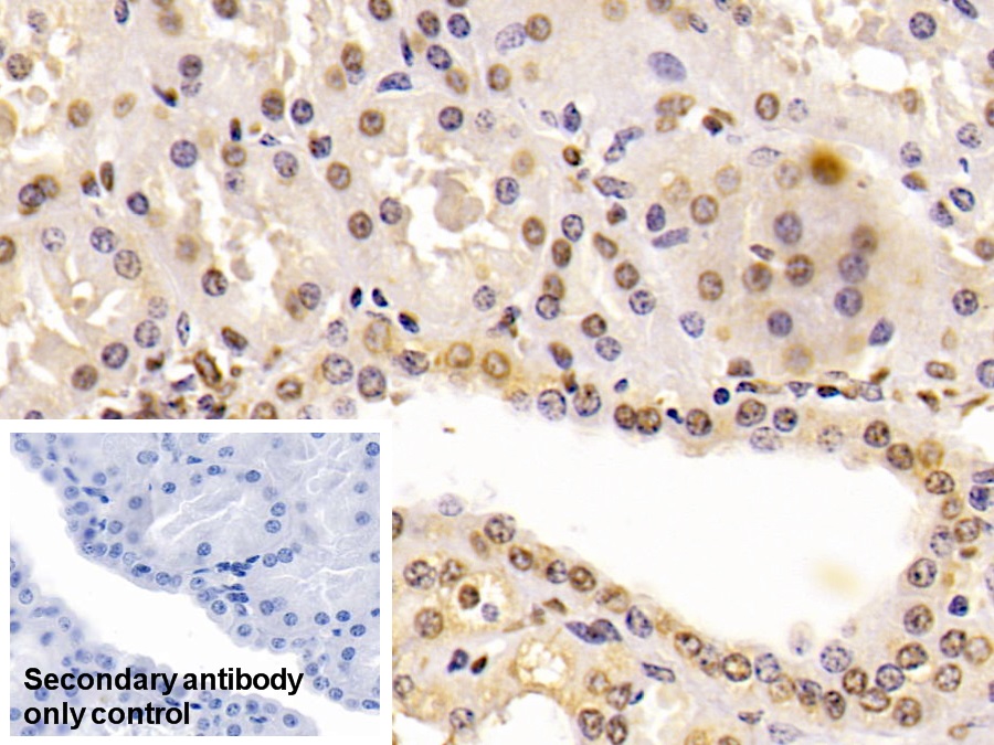 Monoclonal Antibody to Enolase 1 (ENO1)