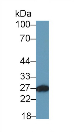 Monoclonal Antibody to Azurocidin (AZU)