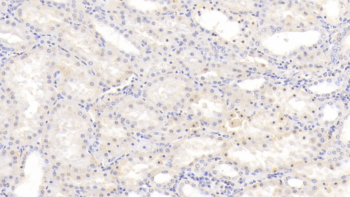 Monoclonal Antibody to Heparin Binding Epidermal Growth Factor Like Growth Factor (HBEGF)