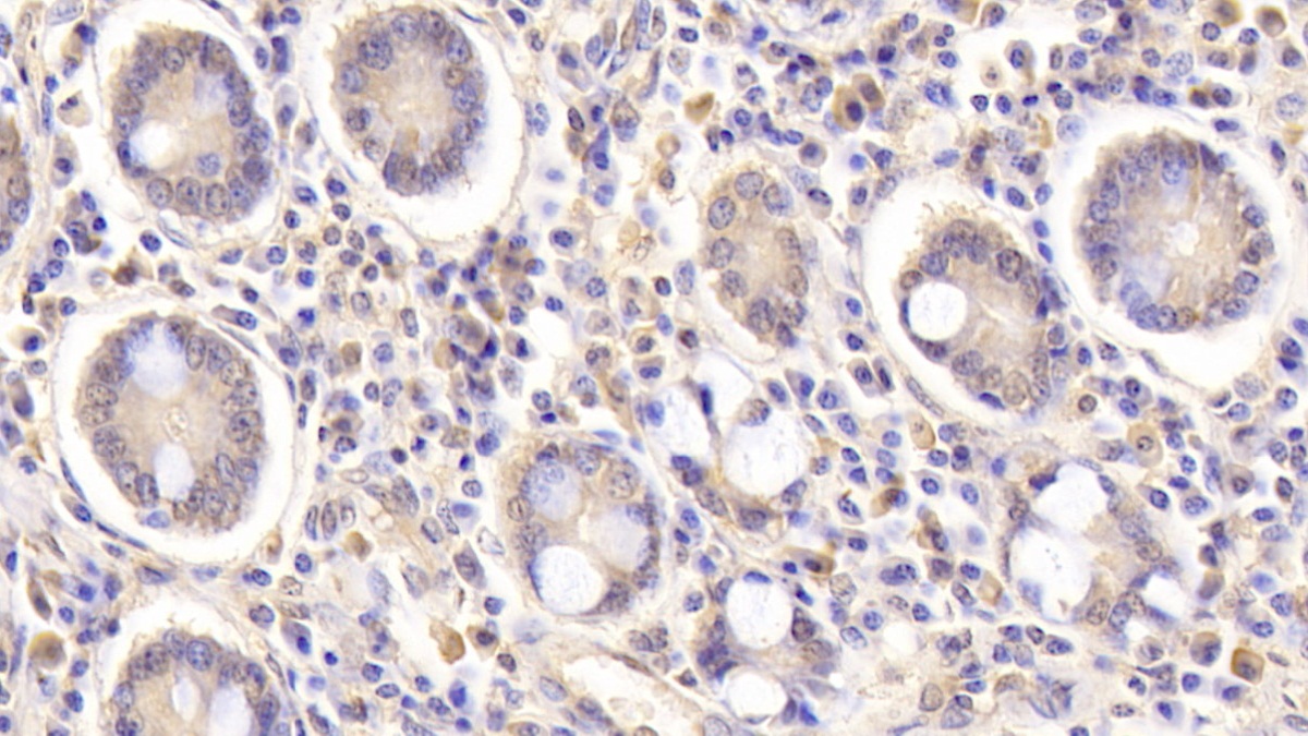 Monoclonal Antibody to Heparin Binding Epidermal Growth Factor Like Growth Factor (HBEGF)